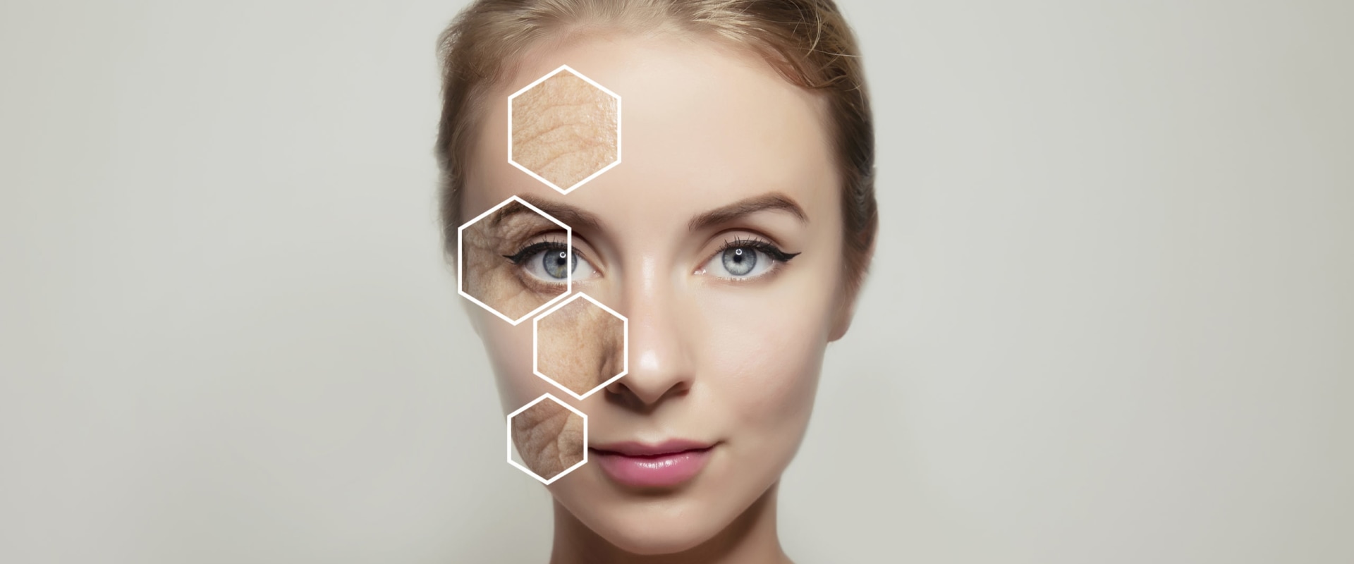 Morpheus8: The Latest Trend in Technology for Dissolving Filler